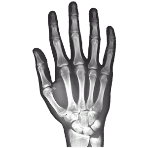 X-Ray Right Hand FREE.apk 1.5