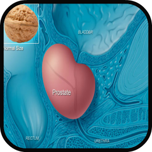 Prostate Cancer Symptoms.apk 1.0