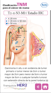 How to download Clasificación TNM cáncer mama patch 1.0 apk for bluestacks
