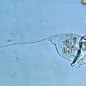 Vorticella