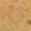 Pork Tapeworm [Embryonated Eggs]