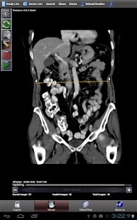 How to download Advanced Radiology Connect 1.7 patch 1.9.0 apk for bluestacks