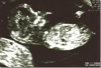 8_7_13 Ultrasound pics