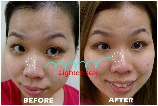 [Cellnique%2520Intensive%2520Hydro%2520Serum%2520review%255B4%255D.jpg.webp]