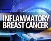 Inflammatory Breast Cancer 2