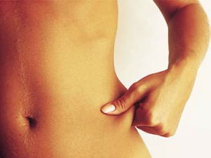 [existe-diferenca-entre-a-gordura-boa-e-a-ruim%255B2%255D.jpg]