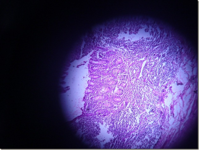 acute appendix under microscope