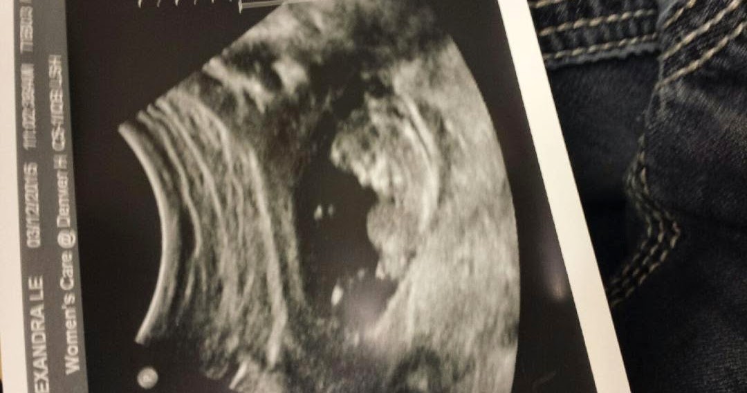 The College Drop Out Success Story In The Making Are Babies That