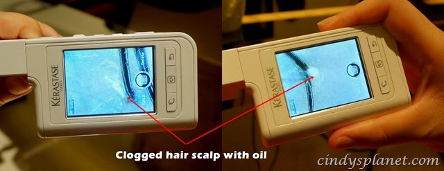 [Kerastase%2520Scalp%2520Detox%2520review%255B2%255D.jpg.webp]