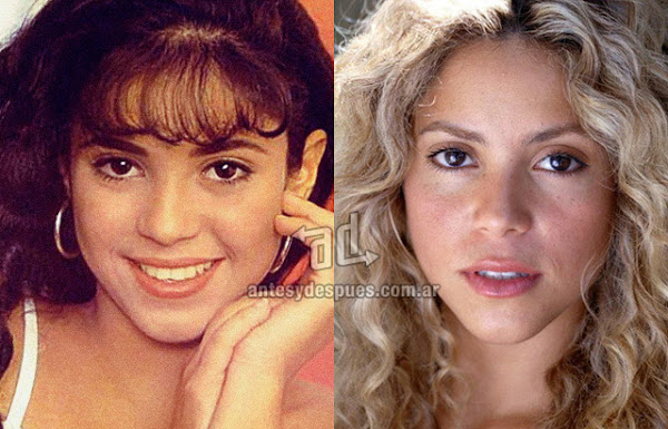 La nueva nariz operada de Shakira