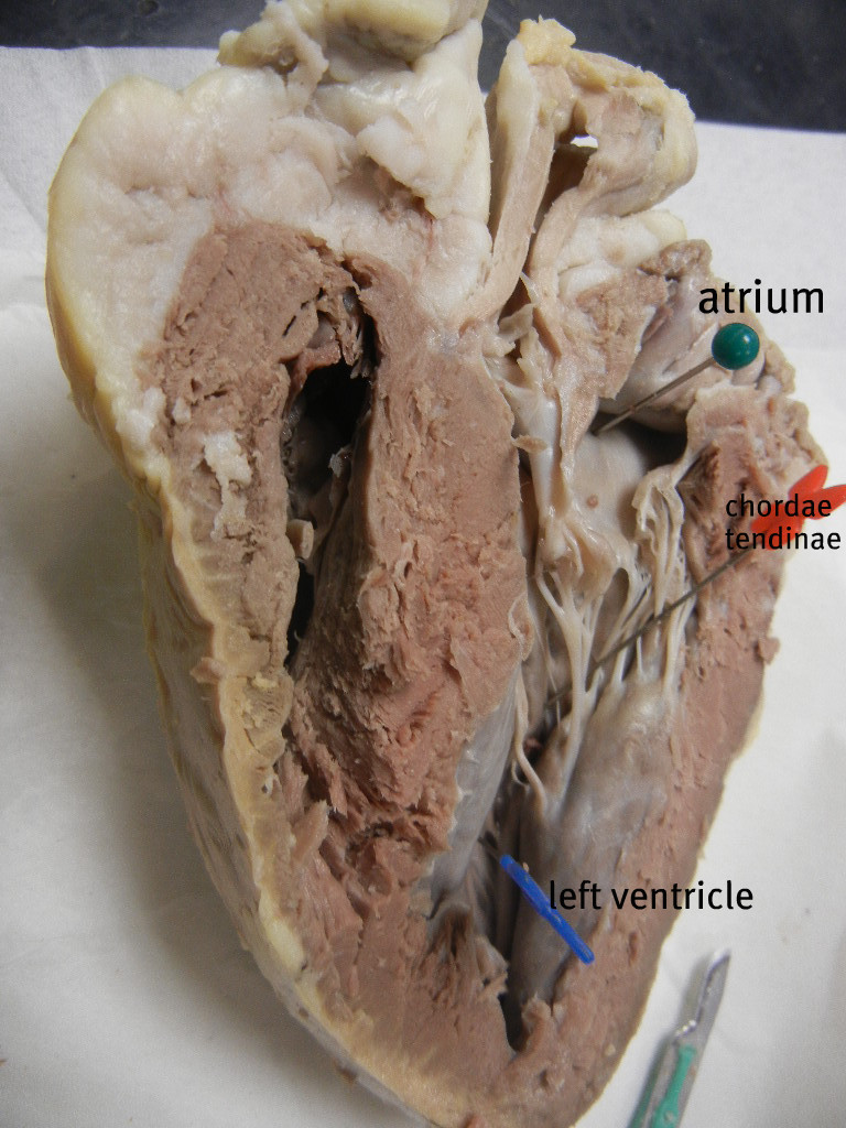 heart_with_pins_labeled.JPG label nerve diagram 