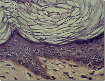 squamous keratininzed epithelium magnified under microscope