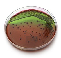 eosinmethylene_e.coli