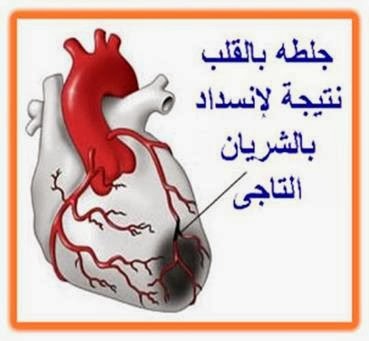 [ischemic%2520heart%255B2%255D.jpg]