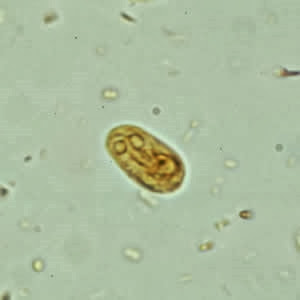 giardia intestinalis o que é