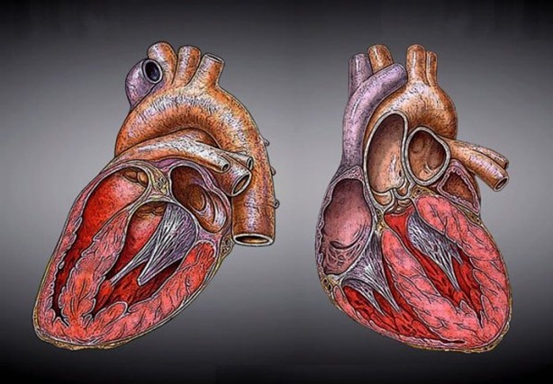 cardiacas