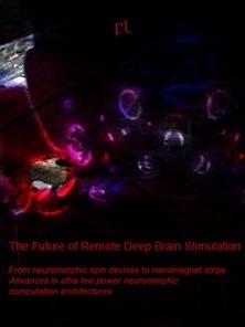 The Future of Remote Deep Brain Stimulation Cover