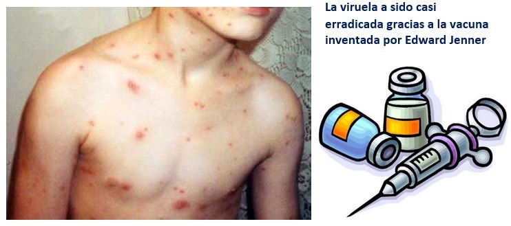 Vacuna viruela - importancia de la quimica
