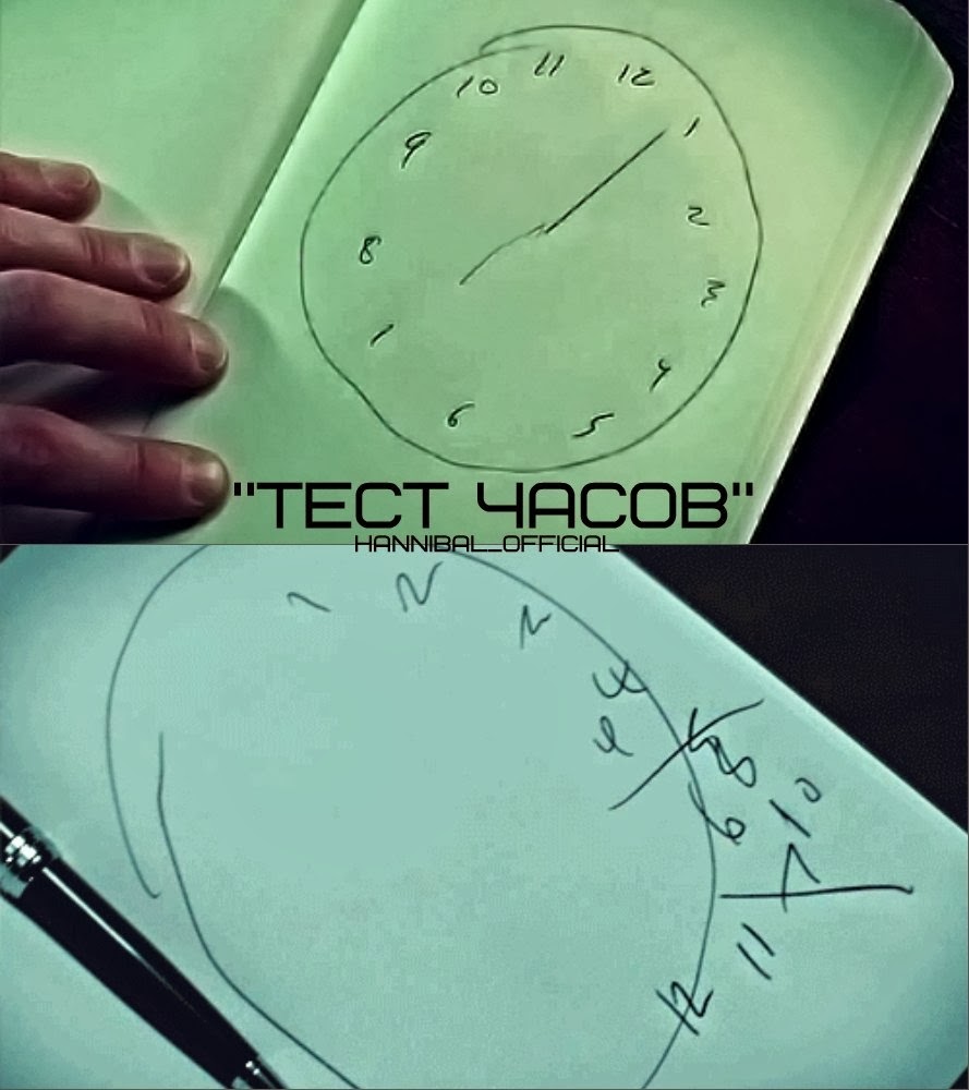 тест с часами. тест с часами. тест рисования часов интерпретация. часы уилла грэма. шкала оценки деменции.