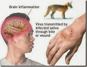 Signs ans symptoms of rabies
