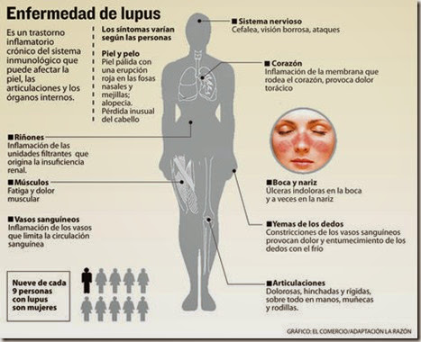 En La Paz se detectan cada año a 130 personas con lupus