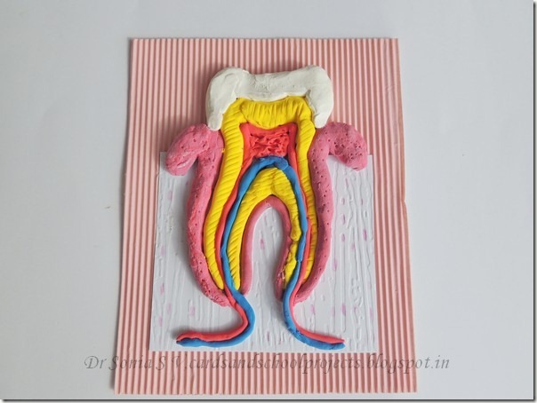 Tooth model 2