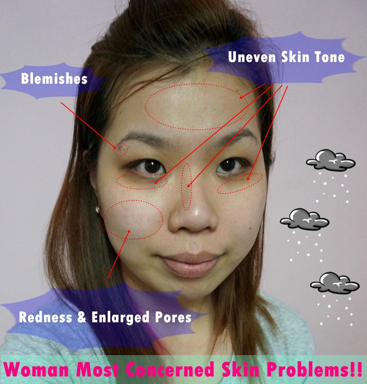 [Skin-Problem5.jpg]