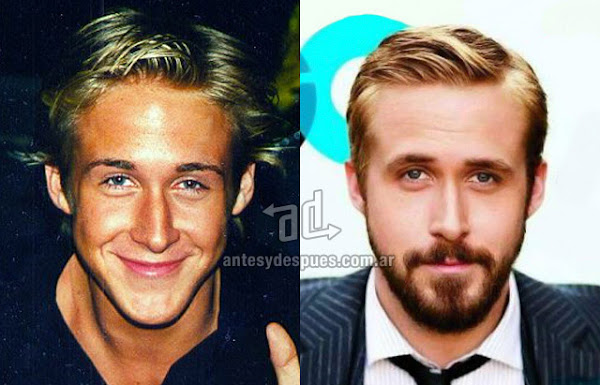 La nueva nariz operada de Ryan Gosling