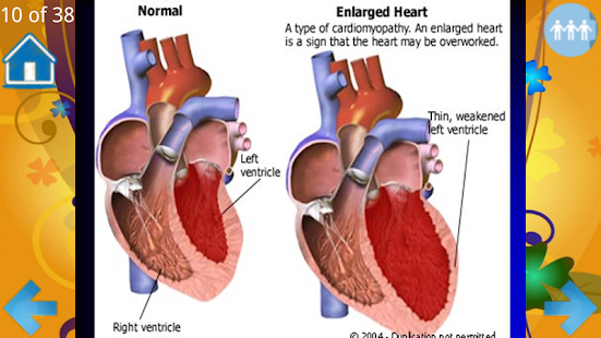Examination of the heart Screenshots 6