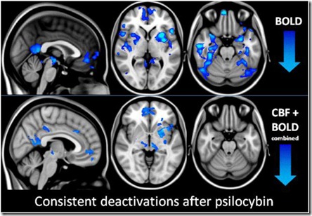 79413680-Neural-Correlates-of-the-Psychedelic-State-as-Determined-by-fMRI-Studies-With-Psilocybin
