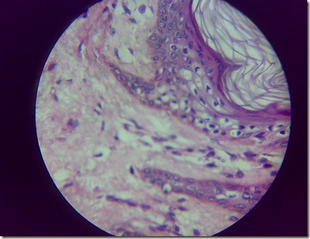 Skin magnified microscopic view