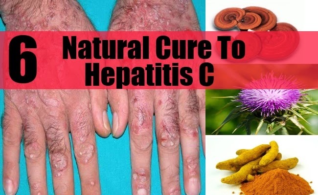[Natural-Cure-For-Hepatitis-C3.jpg]