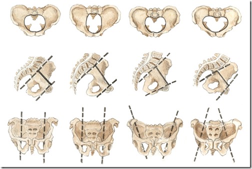 Shapes of female pelvis
