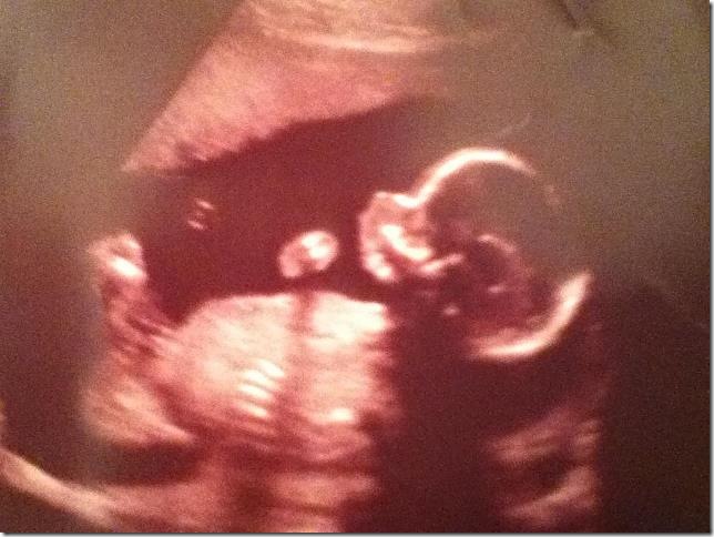 ultrasound baby #2