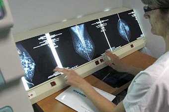 new_breast_cancer_treatment_480_16dec2011