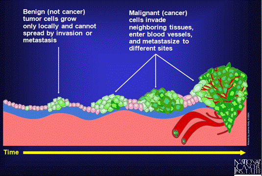 cancer benign vs malignant)