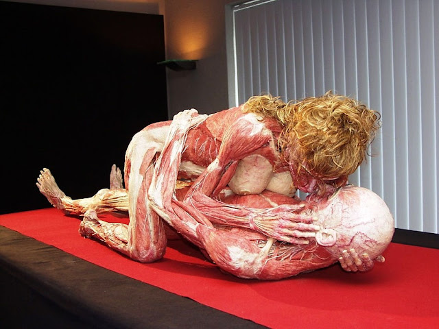 Gunter Von Hagens - 3.jpg