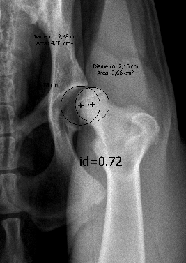 [Indice-distrazione-anca%255B3%255D.png]