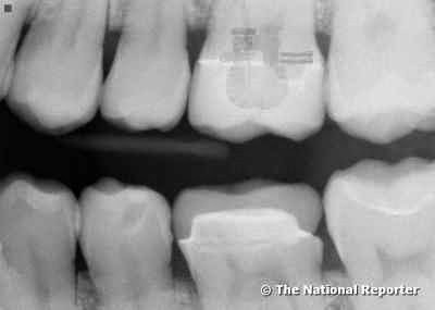 [implante-alienigena-dentes%255B3%255D.jpg]