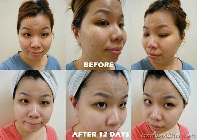 [Visapure%2520review%25203%255B3%255D.jpg.webp]