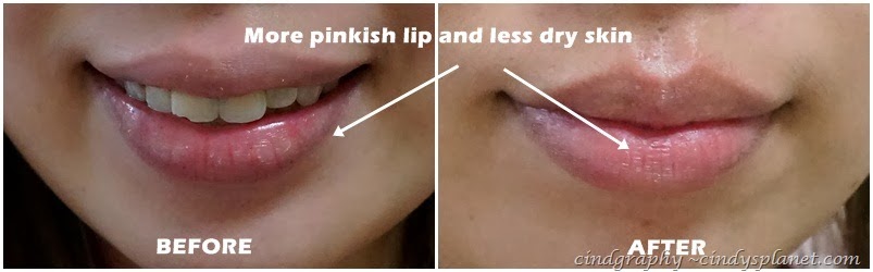 [Evolu%2520eye%2520lip%2520serum%2520result%25203%255B2%255D.jpg.webp]