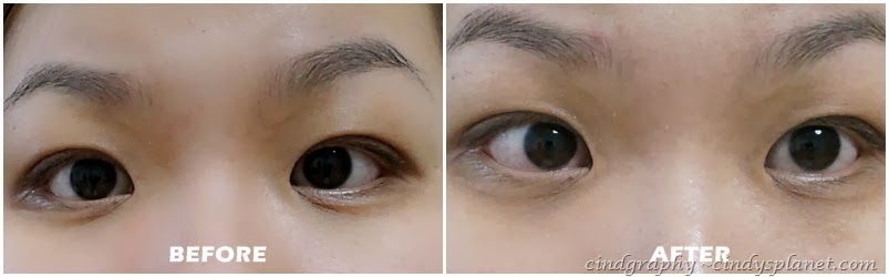 [Evolu%2520eye%2520lip%2520serum%2520result1%255B2%255D.jpg.webp]