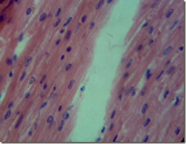 under microscope Cardiac muscle appears as