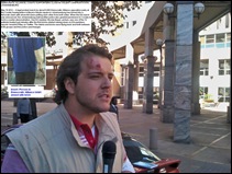 Democratic Alliance march May 15 2012 Cosatu house Nicholaus Bauer injured by brick PIC BY PHILIP DE WET MG
