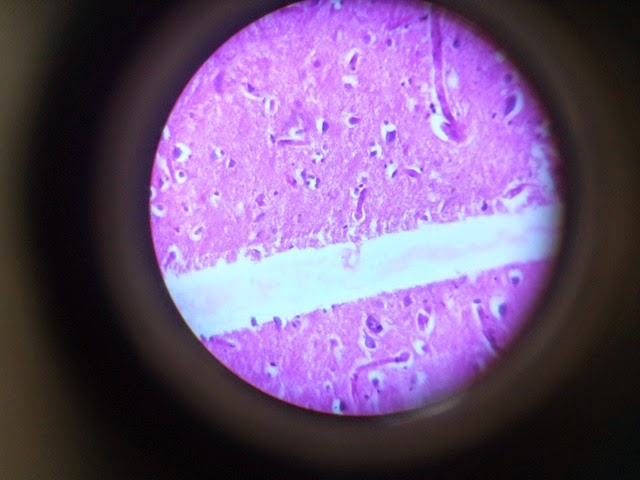 [cerebrum_Histology_slide%255B3%255D.jpg]