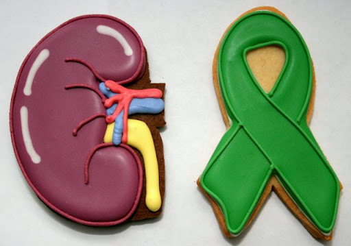 coloring m problem BabyGaga  Cookies  Kidney coloring m problem BabyGaga  Cookies  Kidney