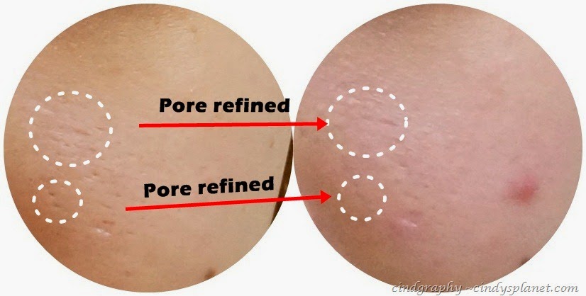 [Yadah%2520Pore%2520Refining%2520review%2520zoom1%255B2%255D.jpg.webp]