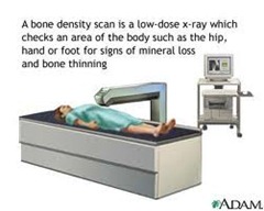 Bone scan