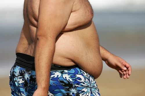 Doenças ligadas à obesidade e ao sobrepeso custam R$ 3,5 bi aos cofres públicos