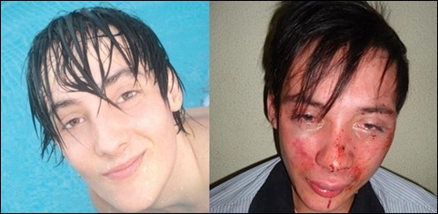 André Barbosa antes e depois da agressão